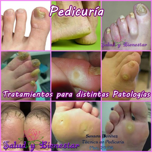 PEDICURIA MASAJES REIKI SALUD Y BIENESTAR 