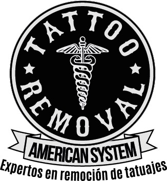 TATTOO REMOVAL AMERICAN SYSTEM